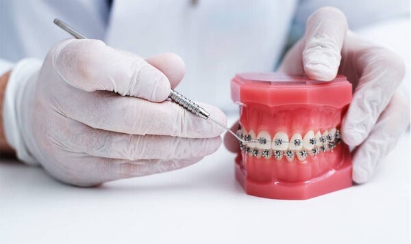 Nha khoa Sài Gòn - Địa chỉ niềng răng uy tín tại TPHCM