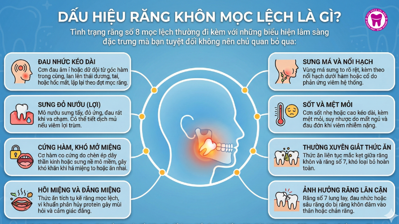 Dấu hiệu răng khôn mọc lệch là gì? Dấu hiệu răng khôn mọc lệch là gì?