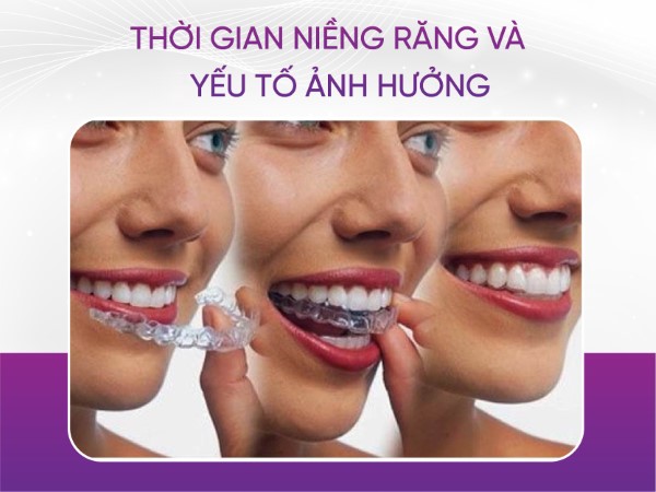 Những yếu tố nào tác động đến thời gian niềng răng trong suốt?