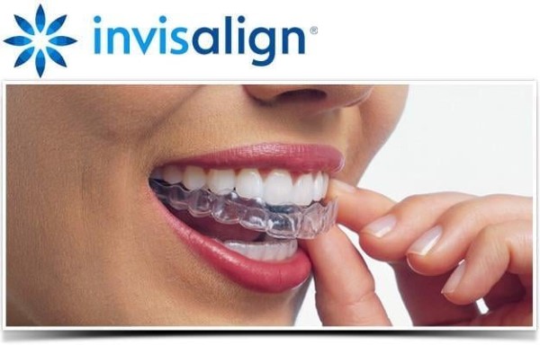 Niềng răng trong suốt Invisalign hiệu quả với Nha Khoa Sài Gòn