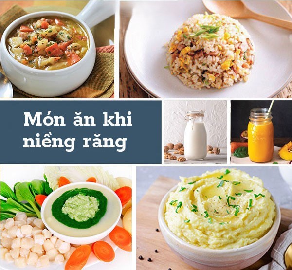 Những thực phẩm nên dùng khi niềng răng