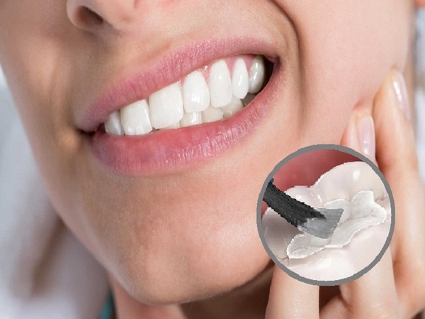 Vì sao dễ bị đau nhức sau một thời gian trám răng?