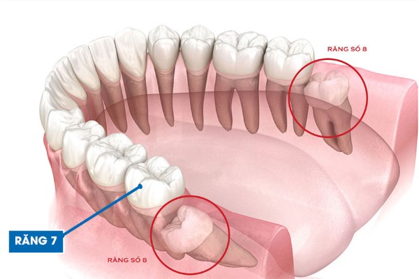 Răng số 8 đã nhổ có mọc lại không?