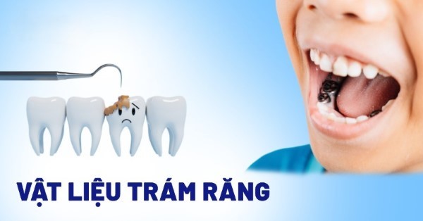 Sử dụng vật liệu trám răng phù hợp