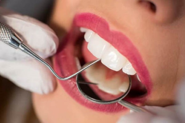 Lấy cao răng tại nha khoa an toàn hiệu quả