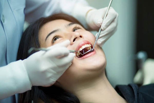 Bao lâu nên lấy cao răng định kỳ?