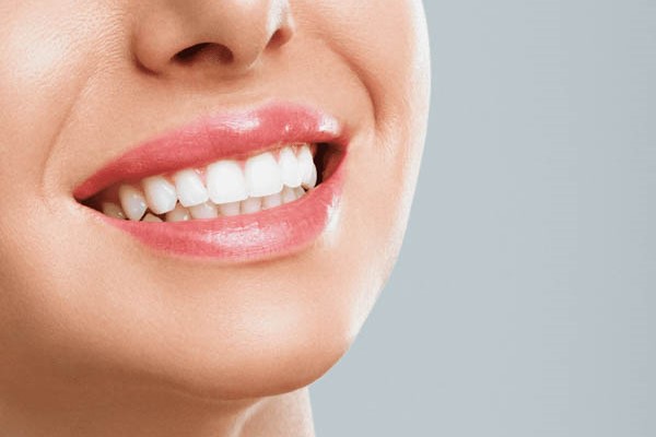 Tẩy trắng răng giữ được bao lâu?