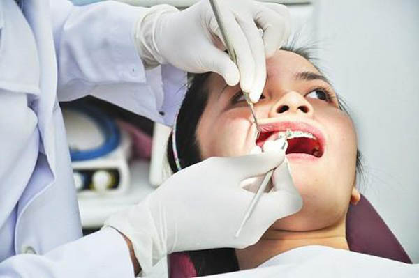 Quy trình nhổ răng khôn chi tiết theo y khoa