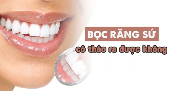 Bọc răng sứ có tháo ra được không?