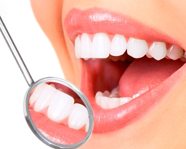 Chi phí bọc răng sứ cho răng hô​?
