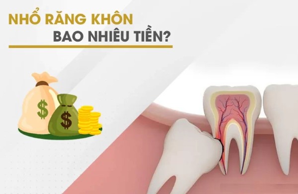 Chi phí nhổ răng khôn bao nhiêu? 
