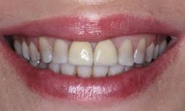 Giải đáp các thắc mắc thường gặp
