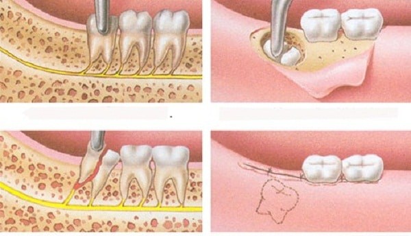 Chọn lựa thực phẩm và chế độ dinh dưỡng lý tưởng