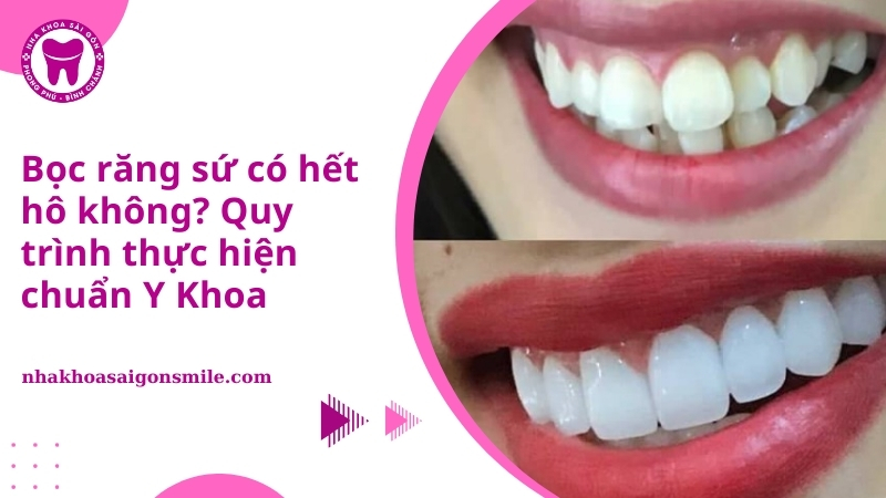 30. Boc rang su co het ho khong Quy trinh thuc hien chuan Y Khoa