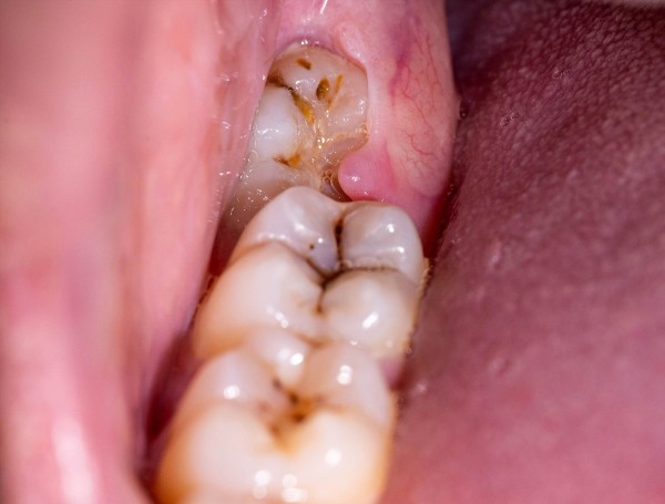 Những lưu ý khi ăn uống