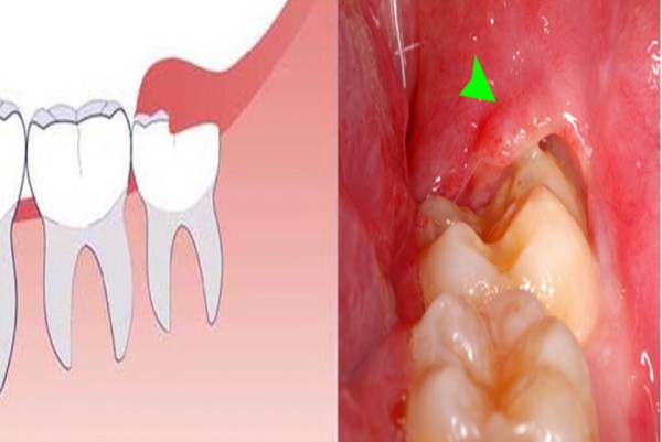Tổng kết và lời khuyên chuyên gia