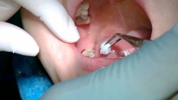 Hỏi đáp và giải đáp thắc mắc thường gặp