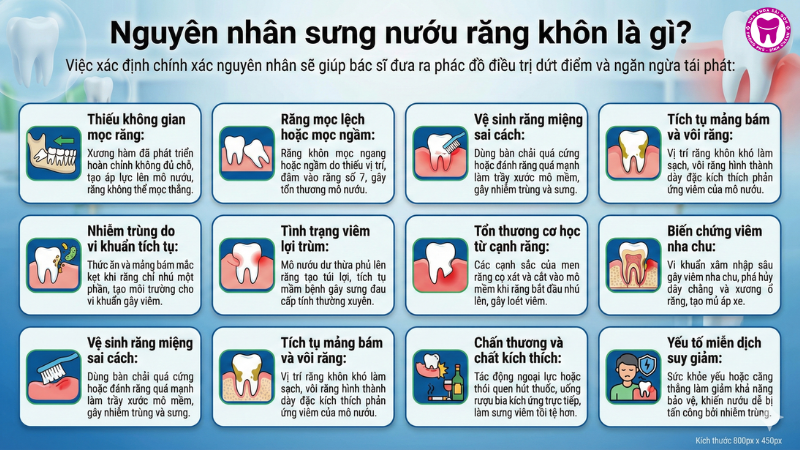 Nguyên nhân sưng nướu răng khôn là gì? Nguyên nhân sưng nướu răng khôn là gì?