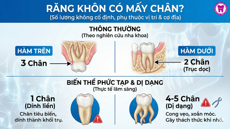 Răng khôn có mấy chân? Răng khôn có mấy chân?