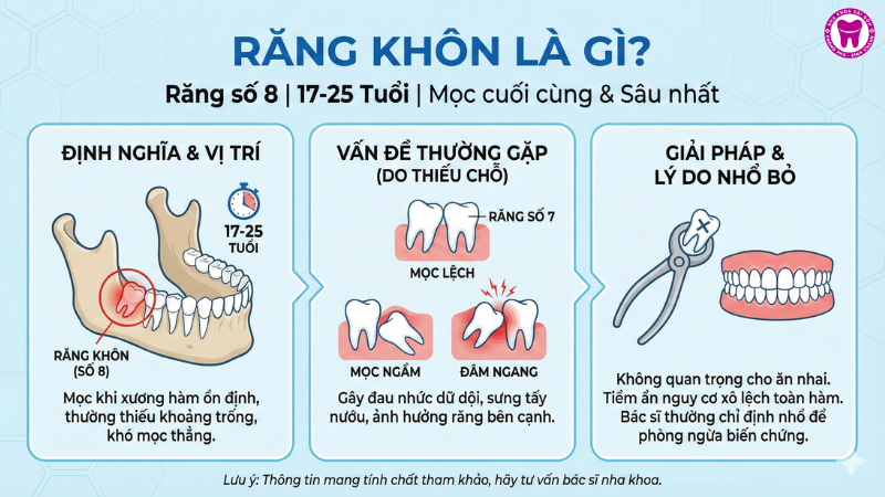 Răng khôn là gì? Răng khôn là gì?