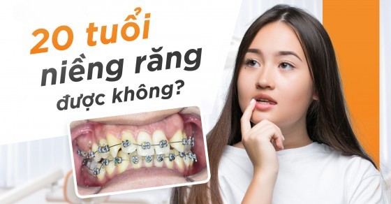 20 Tuổi niềng răng có được không?