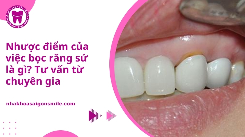 Ngăn chặn tiêu xương hàm và giữ vững cấu trúc răng Một ưu điểm vượt trội của trồng răng Implant là khả năng ngăn chặn tiêu xương hàm — biến chứng thường gặp sau khi mất răng. Trụ Implant có chức năng dẫn truyền lực từ việc ăn nhai đến xương hàm, kích thích mô xương phát triển và duy trì mật độ xương ổn định. Nhờ vậy: Hạn chế tiêu xương. Ngăn ngừa tình trạng răng xô lệch, lệch khớp cắn. Giúp Cô Chú, Anh Chị ăn nhai thoải mái, an toàn lâu dài.