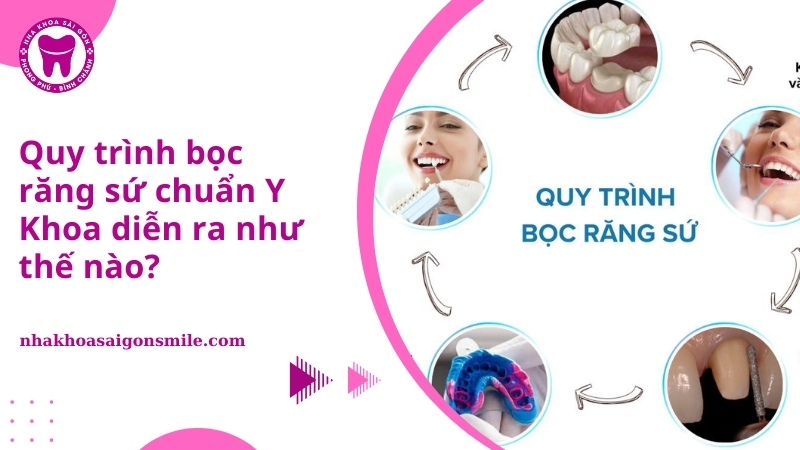 quy trình bọc răng sứ