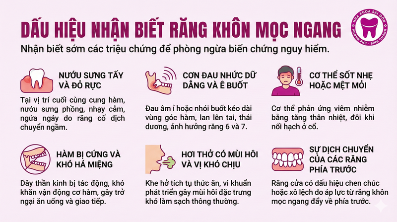 Dấu hiệu nhận biết răng khôn mọc ngang là gì? Dấu hiệu nhận biết răng khôn mọc ngang là gì?