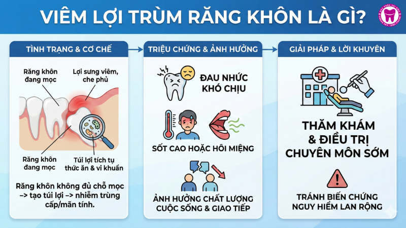 Viêm lợi trùm răng khôn là gì? Viêm lợi trùm răng khôn là gì?