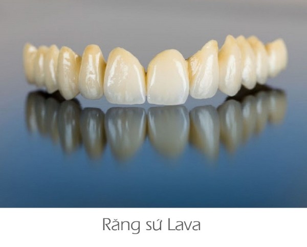 Răng sứ cao cấp (Ceramil, Lava…)