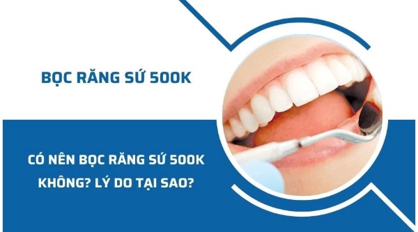 Giới thiệu về bọc răng sứ 500k