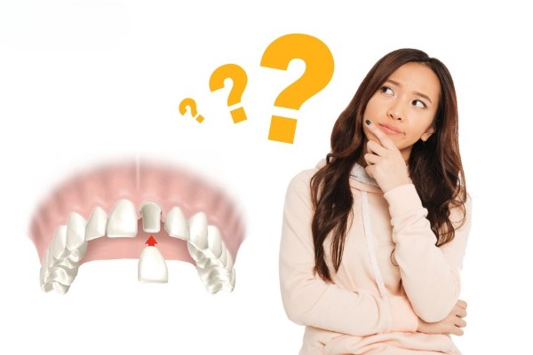Những điều cần biết trước khi lựa chọn bọc răng sứ 500k