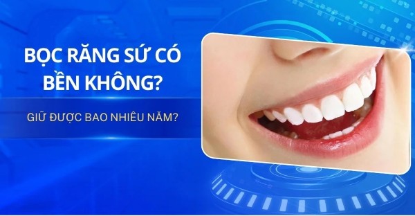 Bọc răng sứ có bền không? Thực tế về độ bền của răng sứ
