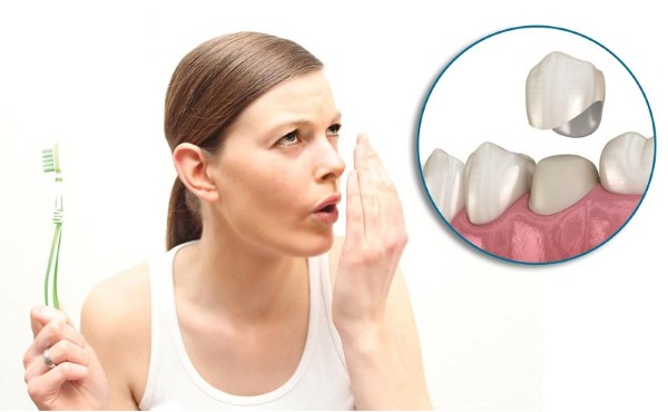 Bọc răng sứ bị hôi miệng do vệ sinh răng miệng kém 