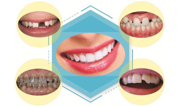 Tình trạng răng miệng của bệnh nhân
