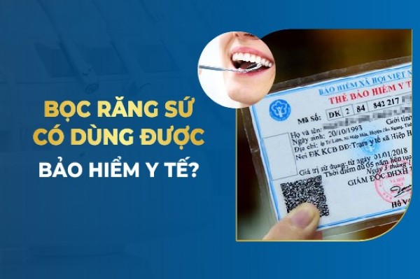 Chính sách bảo hiểm chi trả cho răng sứ