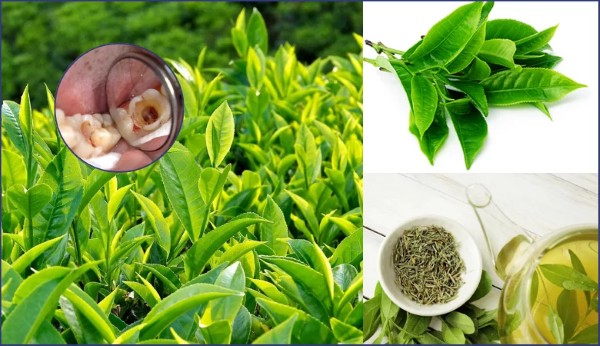 Cách trị nhức răng có lỗ bằng lá trà xanh