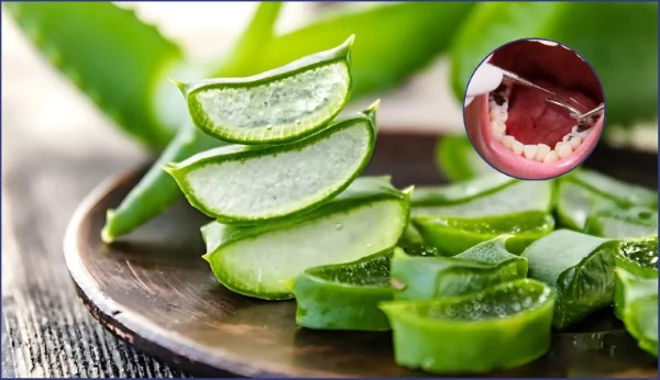 Nha đam – Giải pháp làm dịu cơn đau răng có lỗ tự nhiên