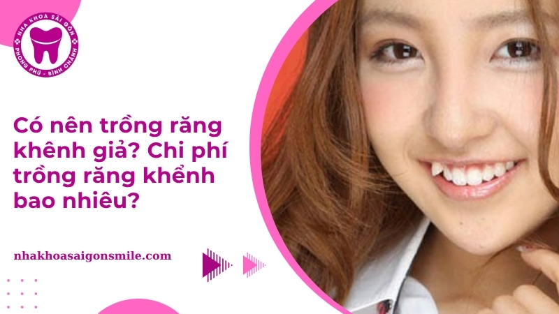Có nên trồng răng khênh giả? Chi phí trồng răng khểnh bao nhiêu?