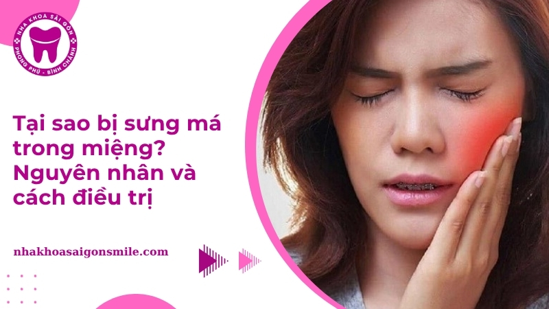 Tại sao bị sưng má trong miệng? Nguyên nhân và cách điều trị