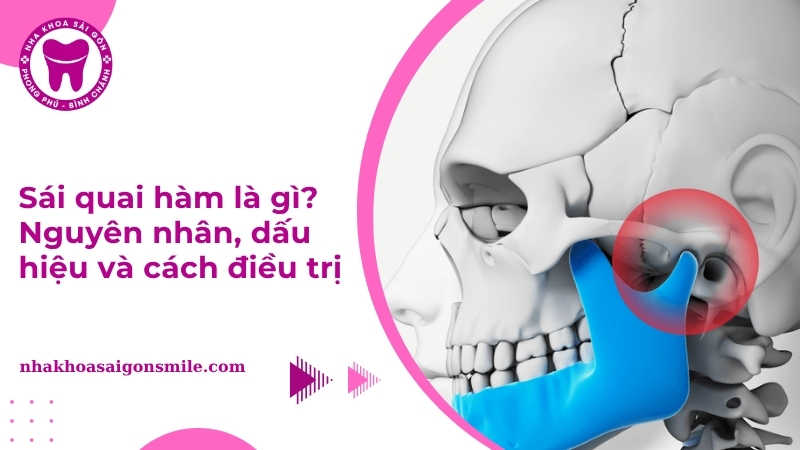 Sái quai hàm là gì? Nguyên nhân, dấu hiệu và cách điều trị