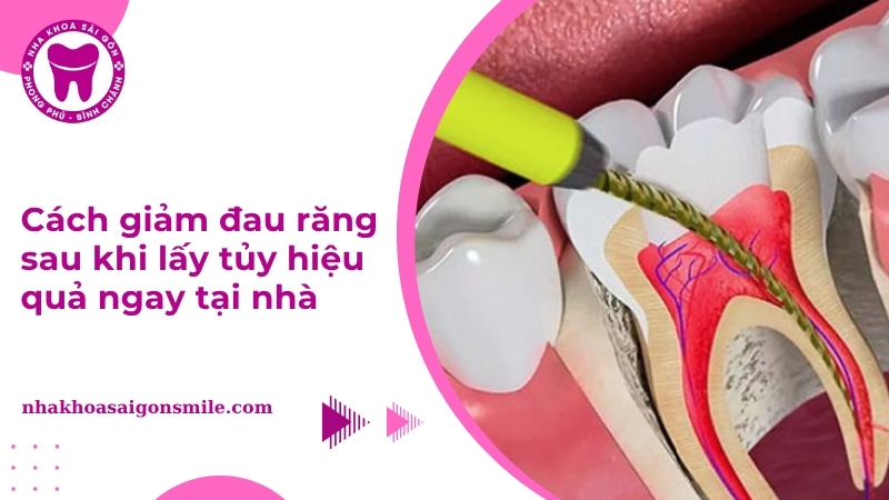 Cách giảm đau răng sau khi lấy tuỷ hiệu quả ngay tại nhà