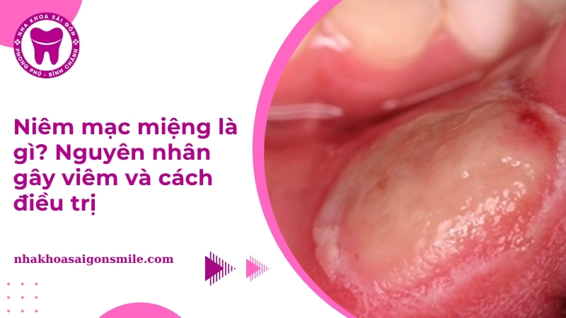 Niêm mạc miệng là gì Cấu tạo, chức năng và cách chăm sóc