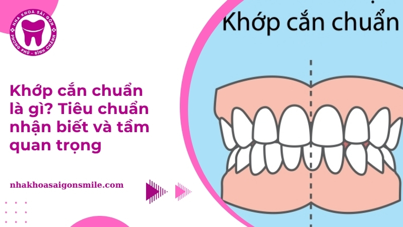 Khớp cắn chuẩn là gì? Làm sao để đạt khớp cắn chuẩn?