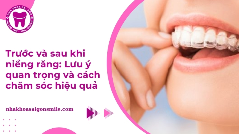 Trước và sau khi niềng răng làm thay đổi gương mặt như thế nào?