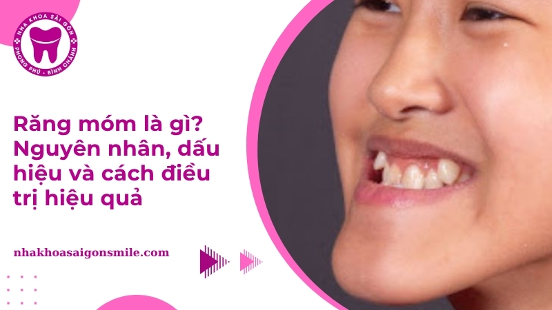Răng móm là gì? Dấu hiệu, nguyên nhân và cách điều trị