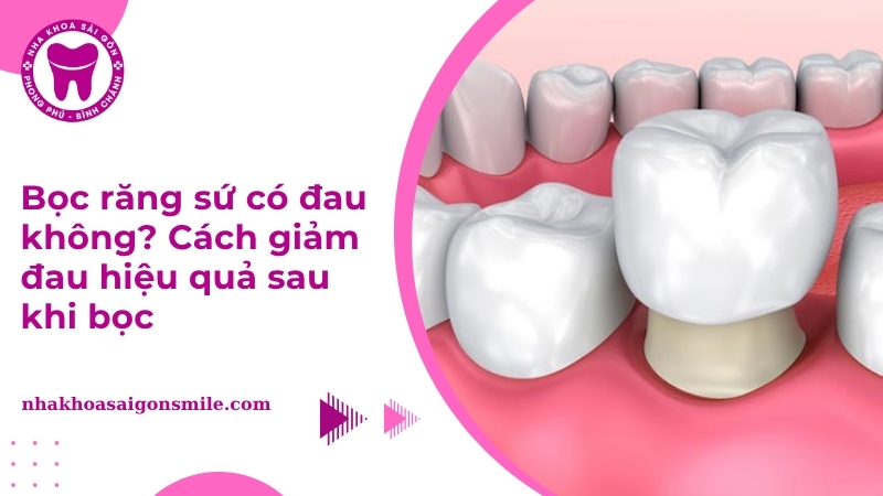 Bọc răng sứ có đau không? Cách giảm đau hiệu quả sau khi bọc