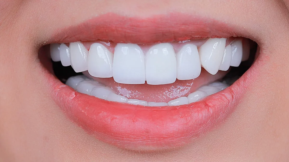 Cấu tạo của răng hàm như thế nào?