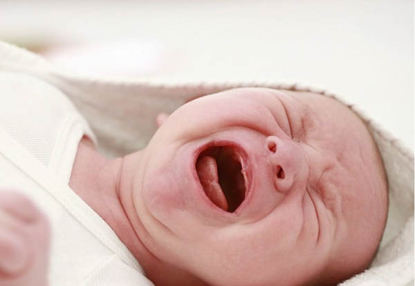 Nanh sữa có gây nguy hiểm cho trẻ sơ sinh không?