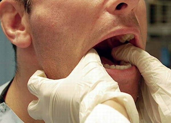 Phương pháp điều trị y khoa cho sái quai hàm hiệu quả